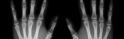 articulo